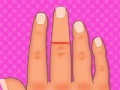 Mäng Finger surgery
