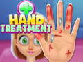 Mäng Hand Treatment
