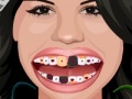 Mäng Selena Gomez Perfect Teeth 